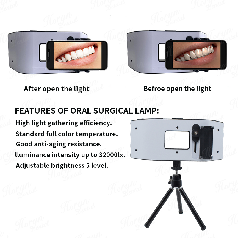 Dental Flash Light Photography - Photography Lighting With Flash recension och pris
